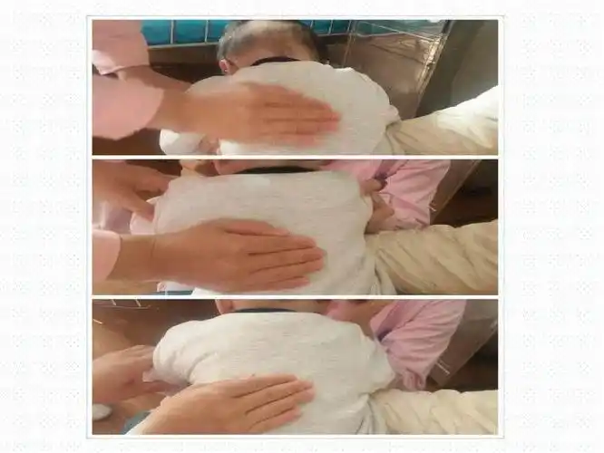 正确认识小儿拍背排痰