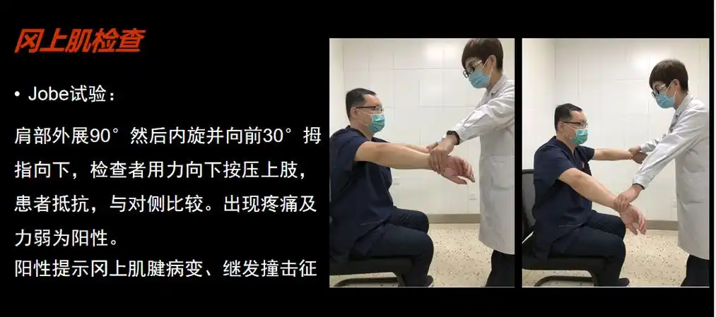 肩袖的不同部位也有不同的检查方法,冈上肌损伤多出现:jobe试验( )