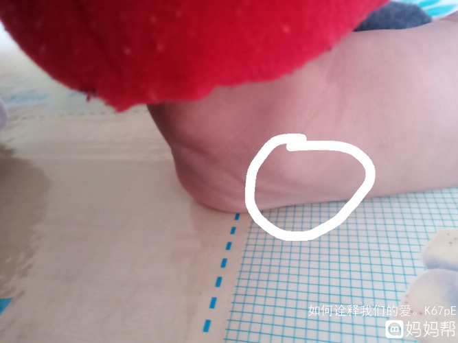 小孩脚踝骨头突出图_发型图片