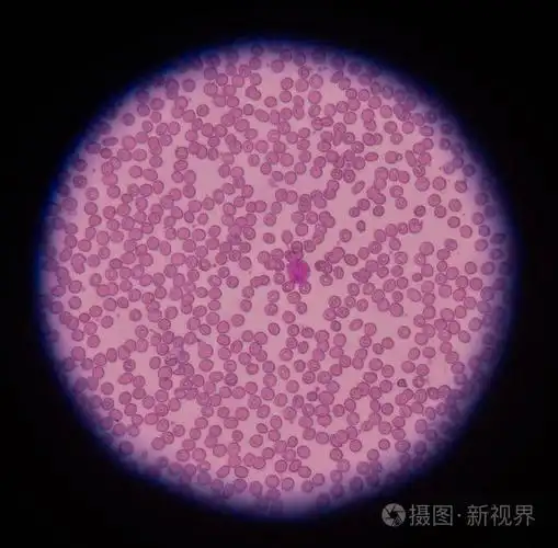 红血细胞显微镜在医学背景概念下照片-正版商用图片0wbnen-摄图新视界