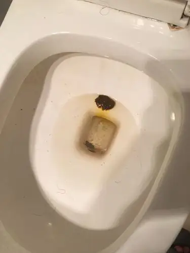 大便的时候发现拉出了一块浮着的 红色 大便 是肠道病变了吗