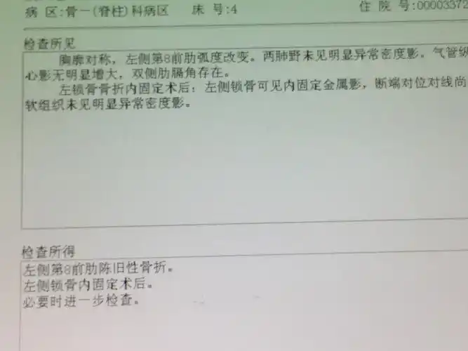 左锁骨骨折一例