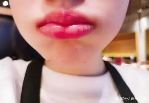 冯提莫吃火锅被辣成香肠嘴,网友七个字评价:性感的烈焰红唇!