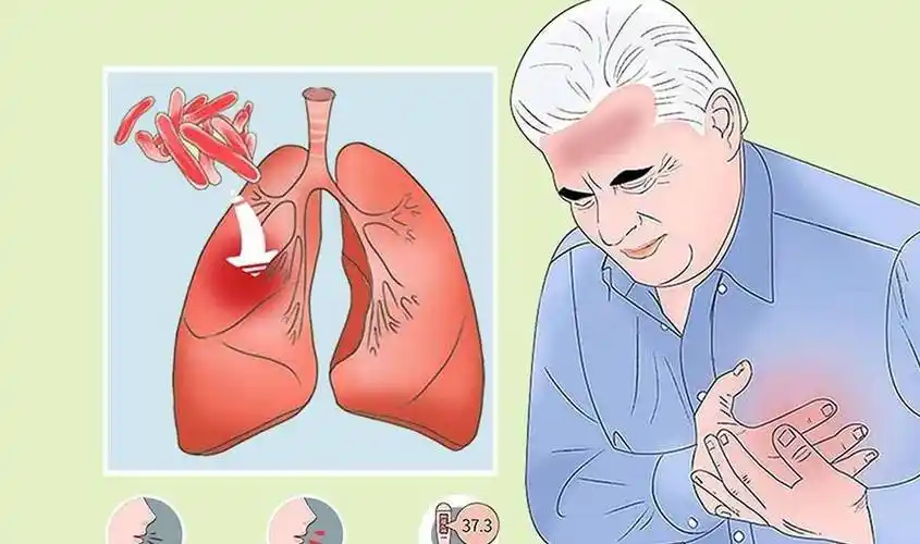 怎样才算肺结核痊愈?_病人_临床_治疗