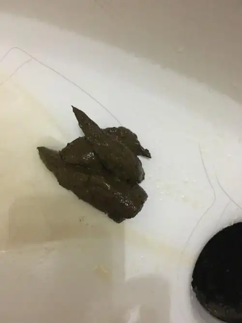 近一个星期大便墨绿色,请问什么原因? 每天早上会运动一个小时,拉