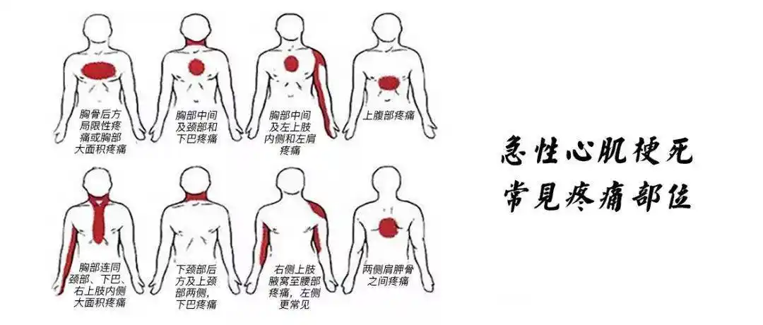 胃痛嗓子疼小心是心肌梗死