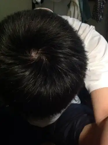 我的发旋这样正常吗,我老是怕自己掉头发,发旋这样正常吗,这是对着