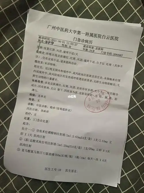 荨麻疹_新冠疫苗_荨麻疹_过敏_疫苗_酒精_医疗健康_医疗药品