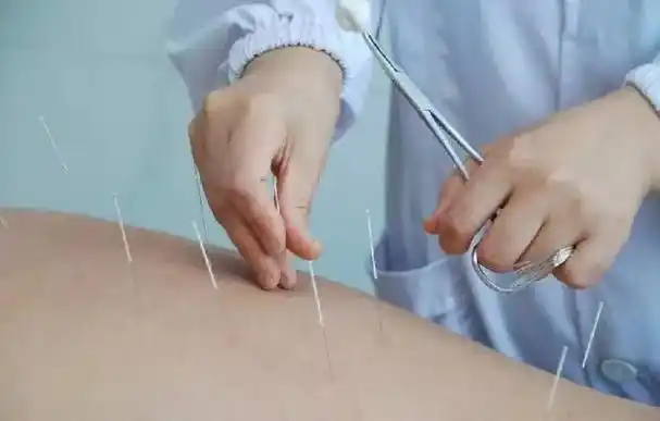 金针王乐亭调理脾胃的老十针