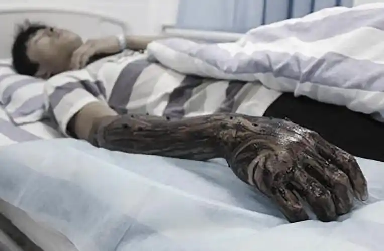 因将生辰八字给了算命老头,我全身溃烂,尿液自己朝外流