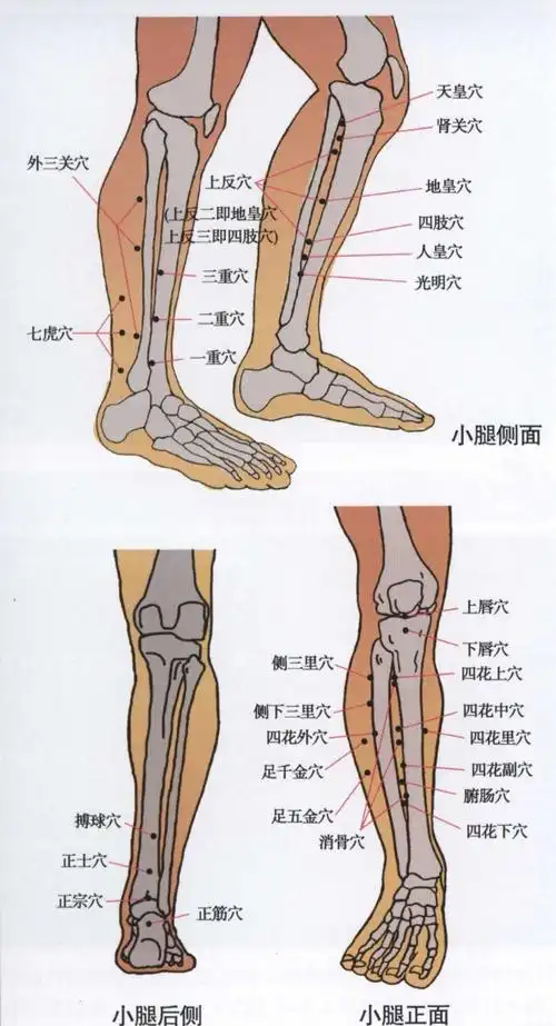 董氏奇穴之侧三里穴,侧下三里穴,足千金穴,足五金穴