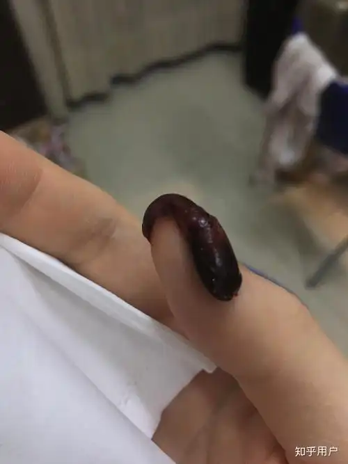 来月经的时候里面好像有肉块一样的东西流出来是什么啊?