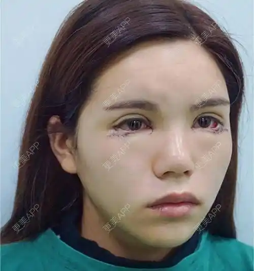 优雅的大娟子的开外眼角日记