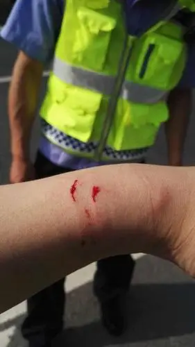 骑车被罚,63岁男子咬伤交警手臂