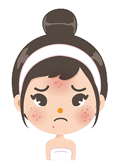 人物-花瓣网|陪你做生活的设计师 | 卡通痘痘脸