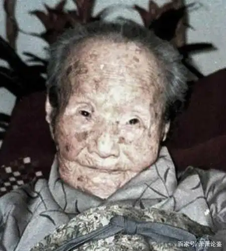 受辐射影响的老人