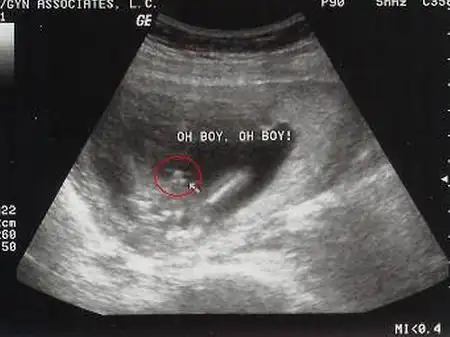 怀孕9周可以看男女吗