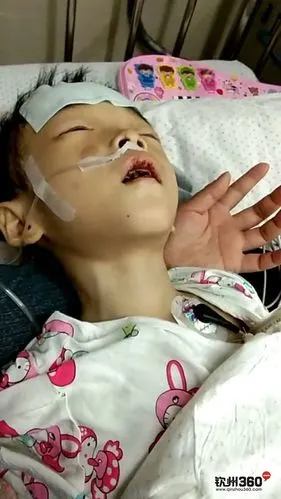 已经住进了重症监护室