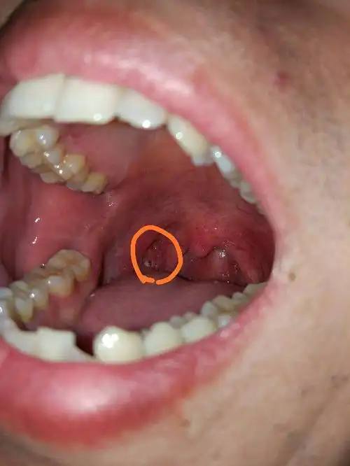 有白点儿的一个洞起什么作用