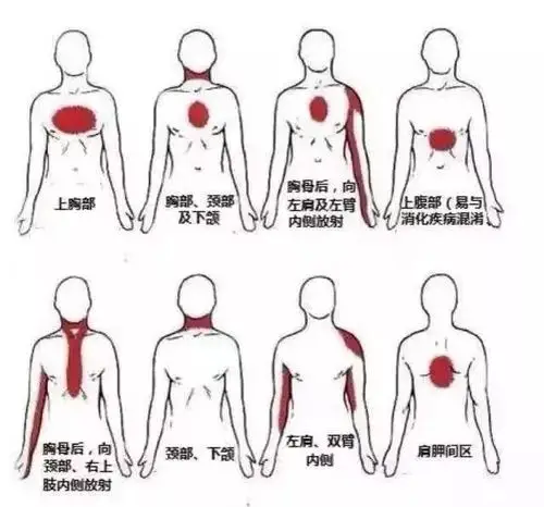 如何辨别心绞痛?这3个方法一定要掌握