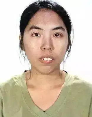 23岁泰国龅牙妹整容后变万人迷,坦言:以前都找不到工作