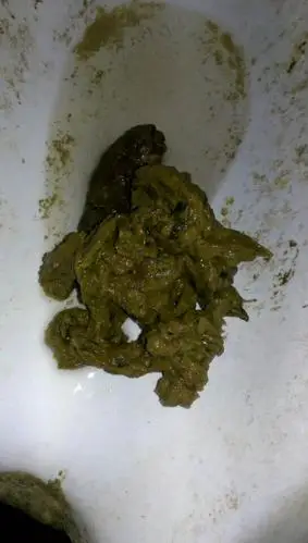 这是正常的大便吗? 形状? 颜色是发黄的