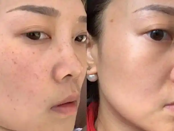 胡可随手一晒,一款祛斑霜火了,陈数:脸上的斑点消失了