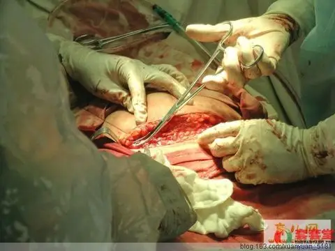 引用 向伟大的母亲致敬——女人分娩全过程 - 红尘过客 - 红尘过客的