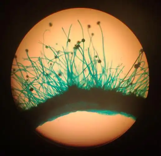 显微镜下的细菌