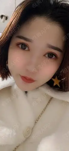 综合术后7天_开眼角术后7天_双眼皮术后7天_眼部整形术后7天_不做叮当