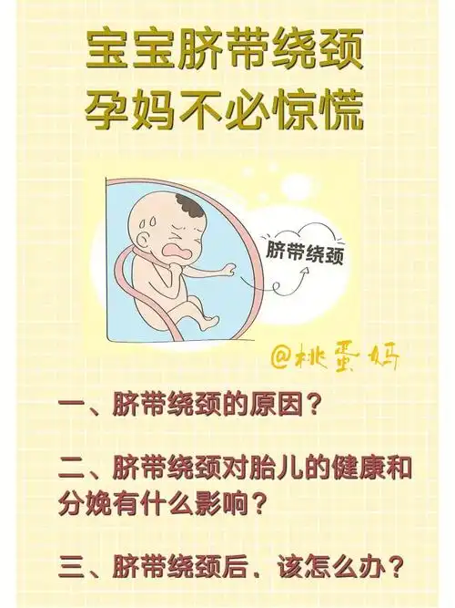 胎儿脐带绕颈不必惊慌