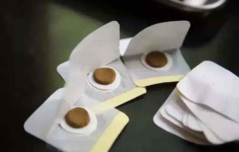 穴位敷贴时根据患者个体差异情况而辩证加减穴位,可照