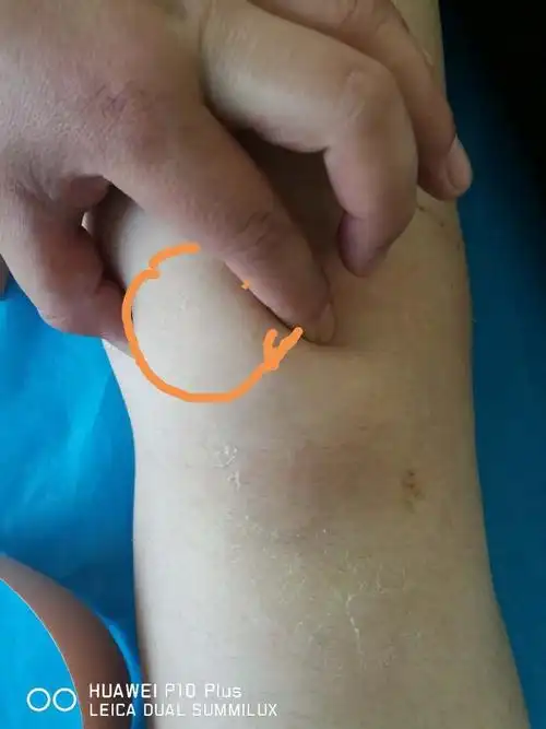 今天就来带大家认识下"神奇"的肌贴