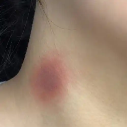 男女通用喜欢种草莓的人2个部位最好不要吸危害不小