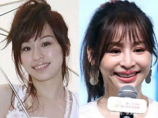这些女星因整形失败脸崩成大妈,面部僵硬太可怕