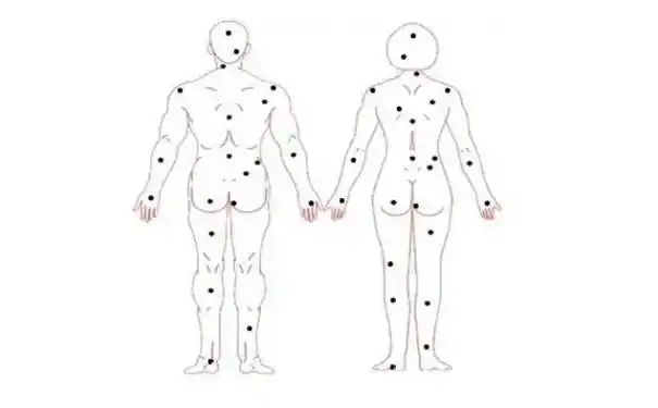 男人臀痣相原来隐秘的痣运势这么好