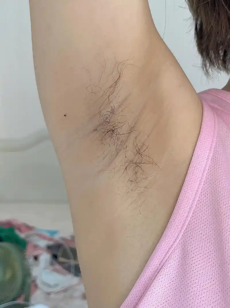 脱毛仪 脱毛仪送了刮毛刀,用起来还是 - 抖音