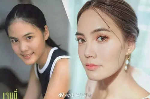 照片&现在照片sunnymariomarknayayamaibellapope泰星十年前后对比赞