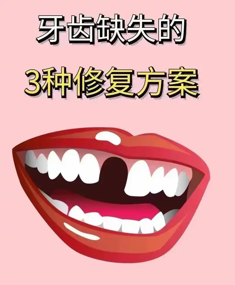7815 7815 今日爱牙小科普:缺牙后的修复方式有哪些?