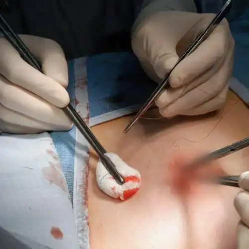 乳房第一杀手,每年两百多万 | 地球知识局|手术|医生|乳腺癌|恶性肿瘤