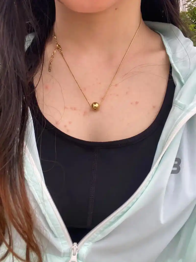 我这是有多少事憋在心里,胸口的痘痘一波未平 ,一波又起 又痛 - 抖音