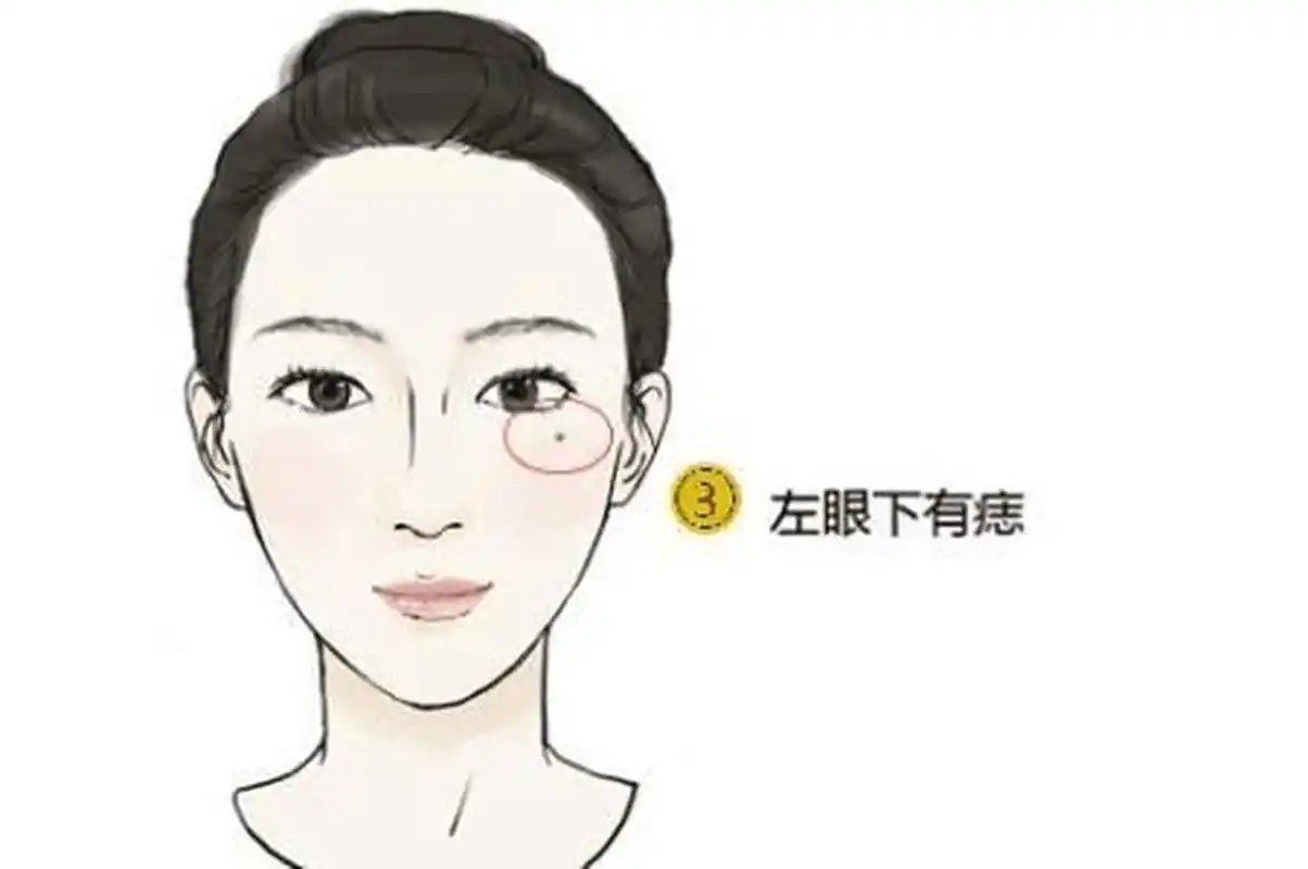 女人右眼有泪痣好吗 女人右眼有泪痣好吗.