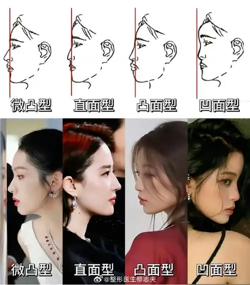 比较理想的是直面型,而微凸面型的下巴略微有些后缩显得中面部有点凸