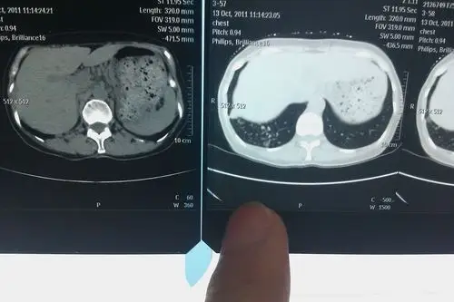 请告诉我 图片里面的两张片子 的区别! 有两张图片的