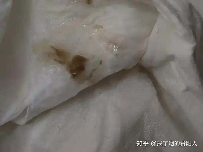 戒烟后吐出来的黑痰是什么物质