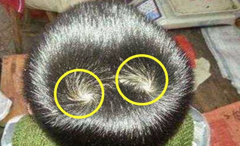 奇闻:头上有几个璇,分别代表着不同的命运,看看你有几个璇!