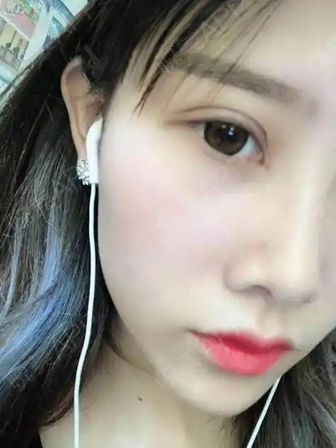 为什么眼综合后眼皮黄,做完眼综合后是什么样的