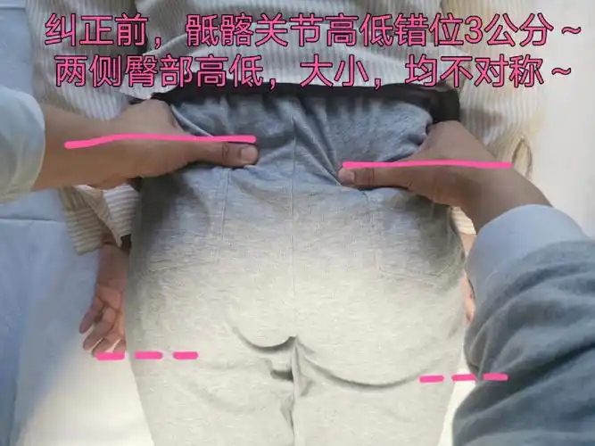 罗氏正骨双桥老太太霍师傅师弟假胯宽