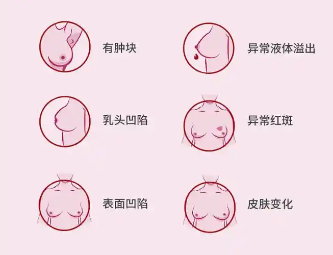 然后举起双臂目测查看乳腺表面皮肤变化,主要是查看是否有:凹陷,皱纹