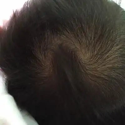 女宝宝头上长两个旋涡,而且往右偏的